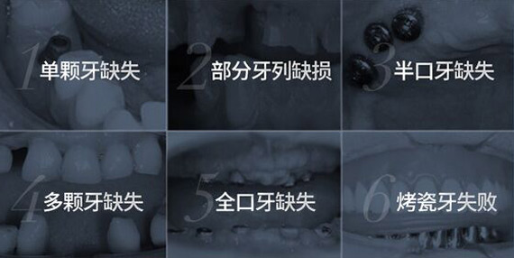 未標(biāo)題-22222.jpg