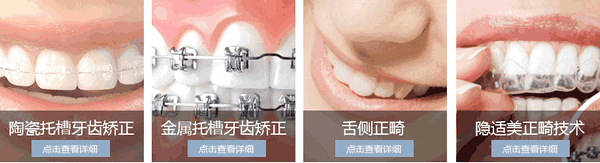 戴牙套的較佳年齡是幾歲