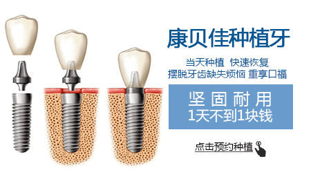 種植牙可以用醫保報銷嗎
