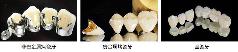 做烤瓷牙去哪兒好-牙.jpg